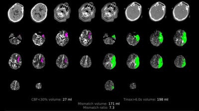 Neuroimaging course brain scan image