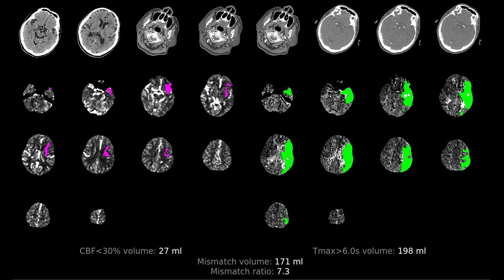 Neuroimaging course brain scan image