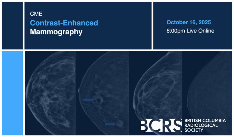 CME Contrast-Enhanced Mammography – BCRS Members